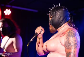 utrikaria-anal-apa-kulta-olten-21-06-2025-40