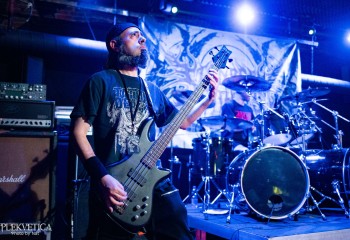 Vulvectomy - Photo by Natalie