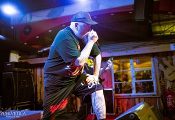 Vulvectomy - Photo by Natalie