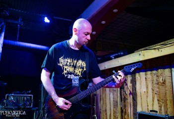 Vulvectomy - Photo by Natalie