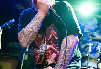 Vulvectomy - Photo by Natalie