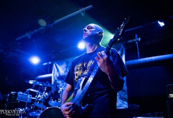 Vulvectomy - Photo by Natalie