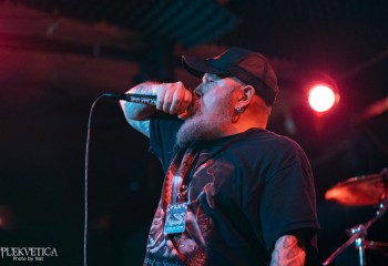 Vulvectomy - Photo by Natalie