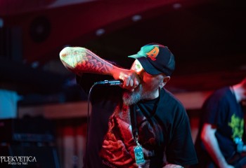 Vulvectomy - Photo by Natalie