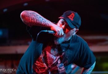 Vulvectomy - Photo by Natalie