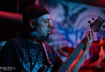 Vulvectomy - Photo by Natalie