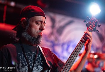 Vulvectomy - Photo by Natalie