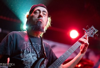 Vulvectomy - Photo by Natalie