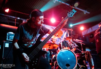 Vulvectomy - Photo by Natalie