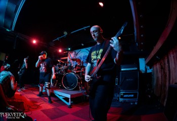 Vulvectomy - Photo by Natalie