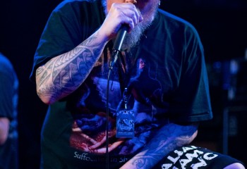 Vulvectomy - Photo by Natalie