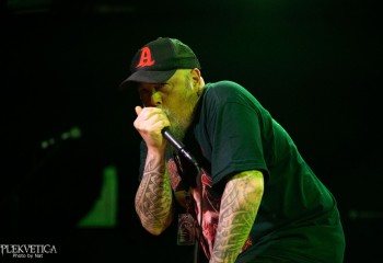 Vulvectomy - Photo by Natalie