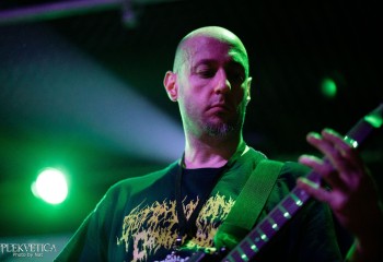 Vulvectomy - Photo by Natalie