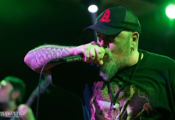 Vulvectomy - Photo by Natalie