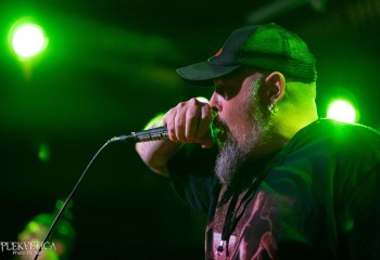 Vulvectomy - Photo by Natalie