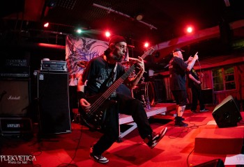 Vulvectomy - Photo by Natalie