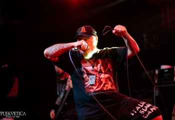 Vulvectomy - Photo by Natalie