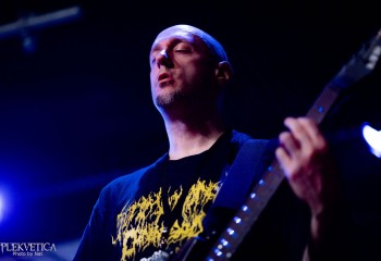 Vulvectomy - Photo by Natalie