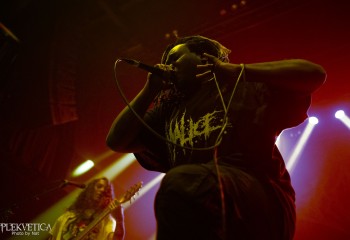 Vulvodynia - Photo by Natalie