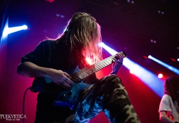 Vulvodynia - Photo by Natalie