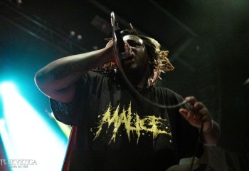 Vulvodynia - Photo by Natalie