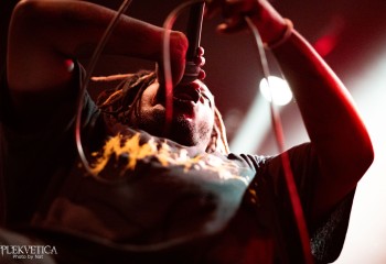 Vulvodynia - Photo by Natalie