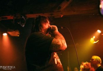 Epicardiectomy - Photo by Natalie