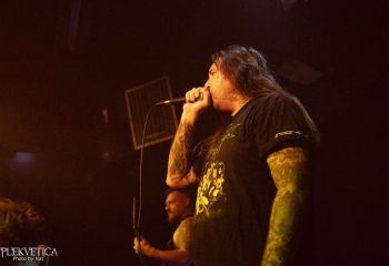 Epicardiectomy - Photo by Natalie