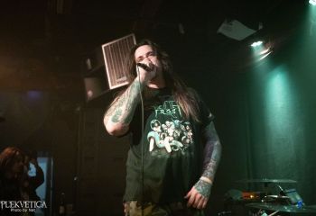 Epicardiectomy - Photo by Natalie