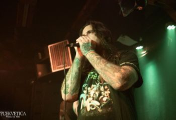 Epicardiectomy - Photo by Natalie