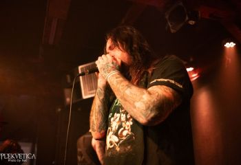 Epicardiectomy - Photo by Natalie