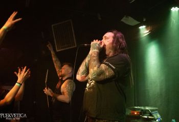 Epicardiectomy - Photo by Natalie