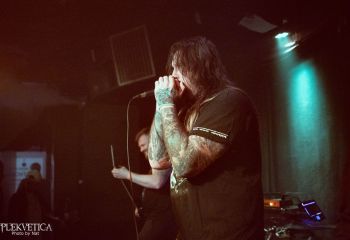 Epicardiectomy - Photo by Natalie