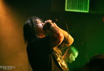 Epicardiectomy - Photo by Natalie