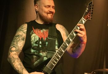 Epicardiectomy - Photo by Natalie