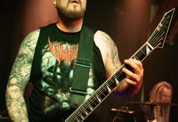 Epicardiectomy - Photo by Natalie