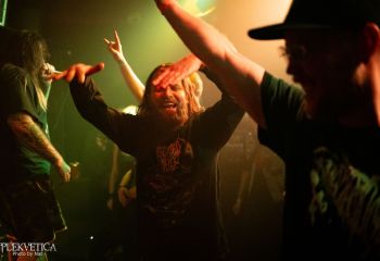 Epicardiectomy - Photo by Natalie