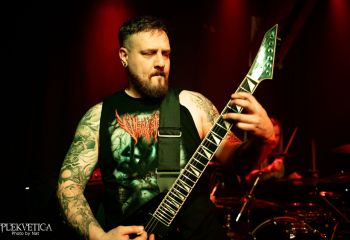 Epicardiectomy - Photo by Natalie